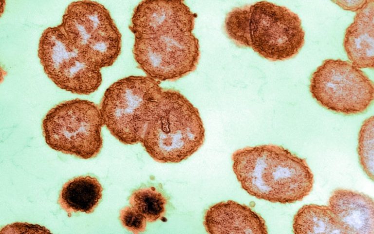 As the Pandemic Wanes, Sexually Transmitted Infections Are Likely to Rise – Scientific American