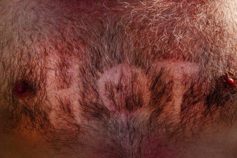 Gay Twitter users proudly show off their hairy chests to prove they aren’t ‘ick’ – Yahoo Eurosport UK