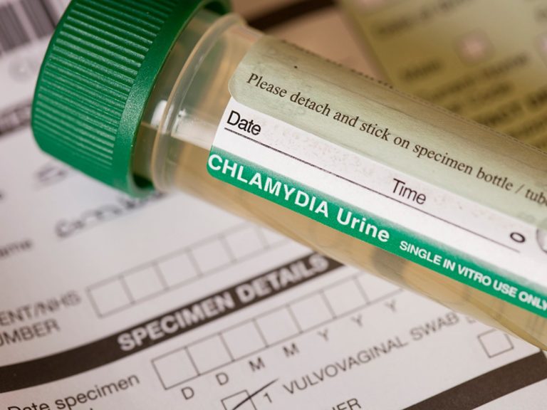 Decision to only test women for chlamydia is ‘disaster’, leading sexual health organisation warns – The Independent