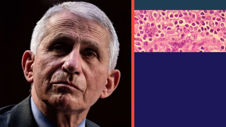 Fauci: Aiming for a “home run” with AIDS research – Yahoo News