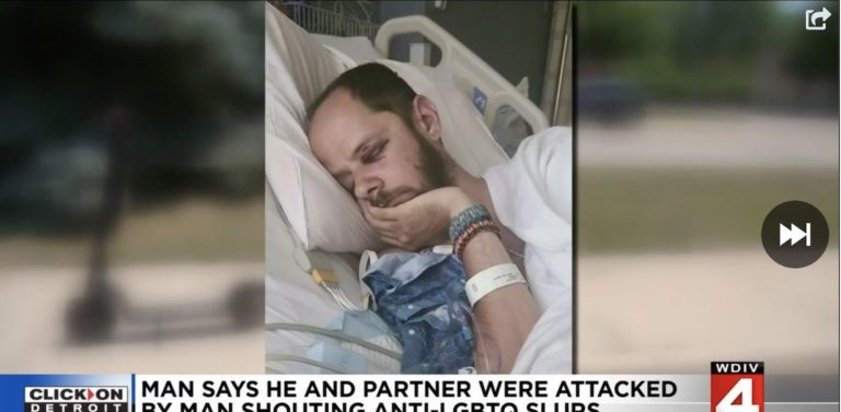 Thug shouting slurs fractures gay man’s skull as his partner screams for help – LGBTQ Nation